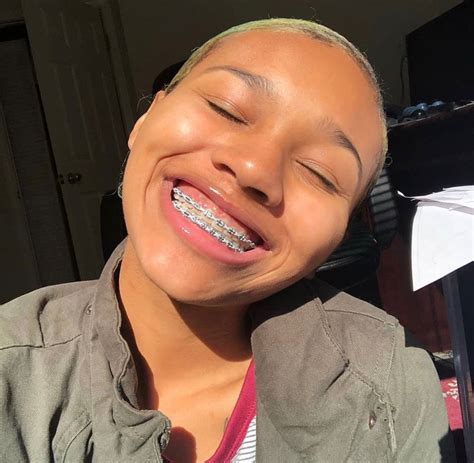 what are the best braces colors for brown hair